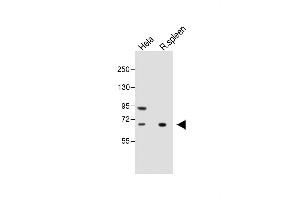 All lanes : Anti-ALOX12 Antibody (C-term) at 1:1000 dilution Lane 1: Hela whole cell lysate Lane 2: Rat spleen whole tissue lysate Lysates/proteins at 20 μg per lane. (ALOX12 抗体  (C-Term))