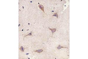 Immunohistochemical analysis of paraffin-embedded H. (Tuberin 抗体  (AA 1397-1426))