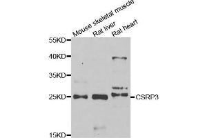 Western blot analysis of extracts of various cell lines, using CSRP3 antibody. (CSRP3 抗体)