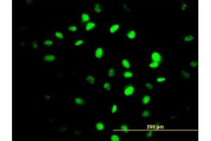 Immunofluorescence of monoclonal antibody to ZNF24 on HeLa cell. (ZNF24 抗体  (AA 1-368))