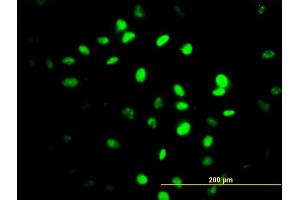 Immunofluorescence of monoclonal antibody to ZNF24 on HeLa cell. (ZNF24 抗体  (AA 1-368))