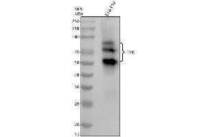 Western blot analysis of TYR using anti-TYR antibody (ABIN7606617).
