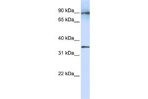 WB Suggested Anti-LRRC59 Antibody Titration:  1 ug/ml  Positive Control:  Fetal Lung cell lysate (LRRC59 抗体  (N-Term))