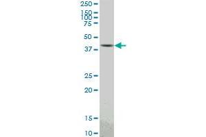 PBK monoclonal antibody (M04), clone 3F7. (PBK 抗体  (AA 1-322))
