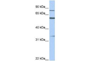 WB Suggested Anti-ZNF16 Antibody Titration:  0. (ZNF16 抗体  (C-Term))