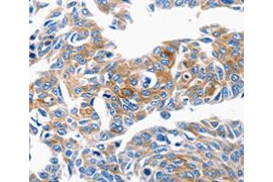 Immunohistochemistry (IHC) image for anti-Chemokine (C-C Motif) Ligand 6 (CCL6) antibody (ABIN2425645) (CCL6 抗体)