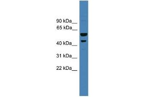 WB Suggested Anti-SERPINB2 Antibody Titration: 0. (SERPINB2 抗体  (Middle Region))