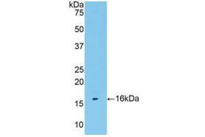 Western blot analysis of recombinant Human TMEM27. (TMEM27 抗体  (AA 17-137))