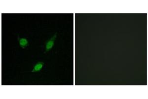 Immunofluorescence analysis of MCF-7 cells, using TACC1 antibody. (TACC1 抗体  (N-Term))