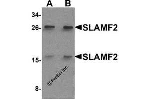 Western Blotting (WB) image for anti-CD48 (CD48) (Middle Region) antibody (ABIN1031096)