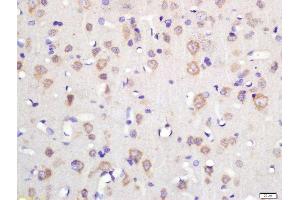 Formalin-fixed and paraffin embedded rat brain labeled with Rabbit Anti-TSPAN12 Polyclonal Antibody, Unconjugated (ABIN2179830) at 1:200 followed by conjugation to the secondary antibody and DAB staining (TSPAN12 抗体  (AA 1-100))