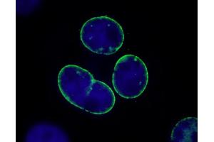 Immunofluorescence (IF) image for anti-Nucleoprotein TPR (TPR) (C-Term) antibody (ABIN7448922) (TPR 抗体  (C-Term))