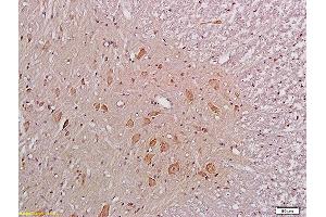 Immunohistochemistry (IHC) image for anti-Glutamate Receptor, Ionotropic, N-Methyl D-Aspartate 1 (GRIN1) (AA 601-700) antibody (ABIN678338)