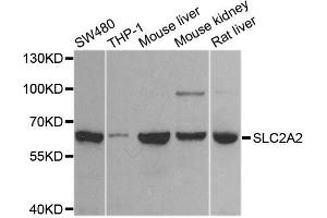 Western blot analysis of extracts of various cell lines, using SLC2A2 antibody (ABIN6003575) at 1/1000 dilution. (SLC2A2 抗体)