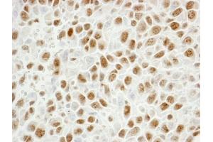 Immunohistochemistry (IHC) image for anti-Proliferating Cell Nuclear Antigen (PCNA) (C-Term) antibody (ABIN7448997)