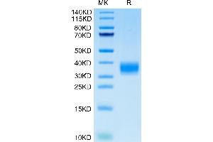 LAMP5 Protein (AA 30-235) (His tag)
