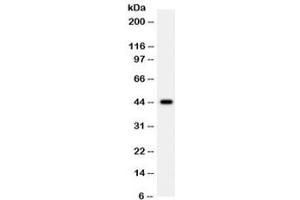 Western blot testing of human 22RV1 cell lysate with WNT2B antibody. (WNT2B 抗体)