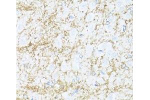 Immunohistochemistry of paraffin-embedded Rat brain using CNP Polyclonal Antibody at dilution of 1:100 (40x lens). (Cnpase 抗体)