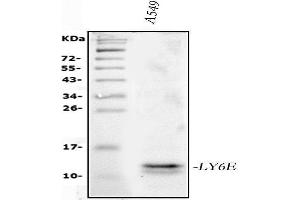 Western blot analysis of LY6E/SCA-2 using anti-LY6E/SCA-2 antibody (ABIN7600591).