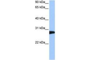 Image no. 1 for anti-N-Ethylmaleimide-Sensitive Factor (NSF) (AA 662-711) antibody (ABIN6744481) (NSF 抗体  (AA 662-711))