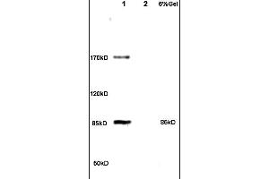 Formalin-fixed and paraffin embedded rat brain tissue labeled with Anti PHLP Polyclonal Antibody,Unconjugated (ABIN715121) at 1:200 followed by conjugation to the secondary antibody and DAB staining. (Phosducin-Like 抗体  (AA 51-150))