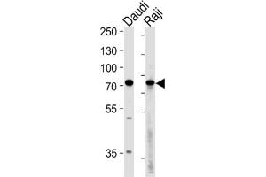 Western Blotting (WB) image for anti-Germ Cell Associated 2 (Haspin) (GSG2) antibody (ABIN3003656) (GSG2 抗体)