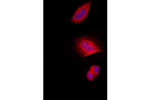 ABIN6257707 and ABIN6274332 staining Hela by IF/ICC. (CHAF1A 抗体  (N-Term))