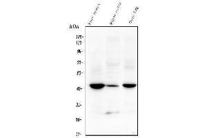 Western blot analysis of TMEM255B using anti-TMEM255B antibody (ABIN7600444). (TMEM255B 抗体  (AA 196-240))