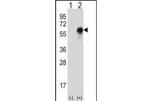 Western blot analysis of LZP (arrow) using rabbit polyclonal LZP Antibody (ABIN655394 and ABIN2844942). (OIT3 抗体)