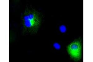 Image no. 3 for anti-Amyloid beta (A4) Precursor Protein (APP) antibody (ABIN1496880) (APP 抗体)