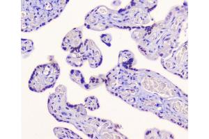 IHC analysis of AES using anti-AES antibody (ABIN6719264).
