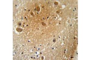 Immunohistochemistry analysis in human brain tissue (Formalin-fixed, Paraffin-embedded) using SPARCL1 / Hevin  Antibody , followed by peroxidase conjugation of the secondary antibody and DAB staining. (SPARCL1 抗体  (Middle Region))