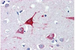 Brain, cortex, Human: Formalin-Fixed, Paraffin-Embedded (FFPE) (USP9X 抗体  (AA 2479-2492))