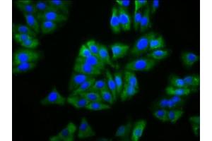 Immunofluorescence staining of HepG2 cells with ABIN7163038 at 1:133, counter-stained with DAPI. (BFSP2 抗体  (AA 11-110))