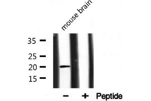 Western Blotting (WB) image for anti-PRA1 Domain Family, Member 2 (PRAF2) (C-Term) antibody (ABIN6262707)