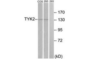 Western blot analysis of extracts from 293/COS7 cells, treated with heat shock, using TYK2 (Ab-1054) Antibody. (TYK2 抗体  (AA 1020-1069))