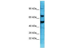 Host: Rabbit  Target Name: Gnl1  Sample Tissue: Mouse Testis lysates  Antibody Dilution: 1.