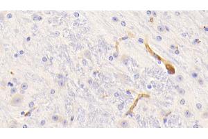 Detection of FGg in Mouse Cerebrum Tissue using Polyclonal Antibody to Fibrinogen Gamma (FGg) (FGG 抗体  (AA 168-405))