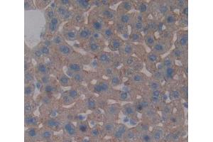 Used in DAB staining on fromalin fixed paraffin- embedded liver tissue (ABCB4 抗体  (AA 1034-1276))