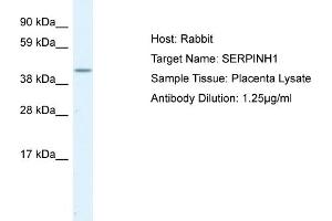 Image no. 1 for anti-Serpin Family H Member 1 (SERPINH1) (C-Term) antibody (ABIN2792207)