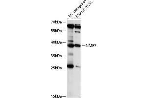 Western blot analysis of extracts of various cell lines, using NME7 antibody (ABIN7269055) at 1:1000 dilution. (NME7 抗体  (AA 1-376))