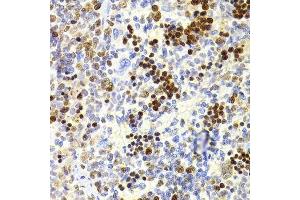 Immunohistochemistry (Paraffin-embedded Sections) (IHC (p)) image for anti-Nuclear Autoantigenic Sperm Protein (Histone-Binding) (NASP) (AA 180-449) antibody (ABIN6144374)