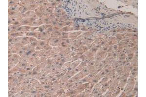 IHC-P analysis of Human Liver Tissue, with DAB staining. (SHC3 抗体  (AA 188-433))