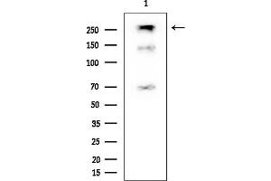 Western blot analysis of lysates from EC304 cells, using Cleaved-Notch2 (Asp1733) Mouse Monoclonal Antibody at 1/1000 dilution.