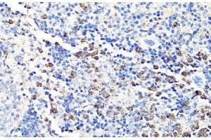 Immunohistochemistry of paraffin-embedded Mouse spleen using S100A9 Polyclonal Antibody at dilution of 1:100 (40x lens). (S100A9 抗体)