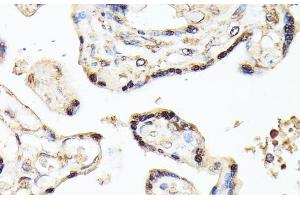 Immunohistochemistry of paraffin-embedded Human placenta using KLF5 Polyclonal Antibody at dilution of 1:100 (40x lens). (KLF5 抗体)