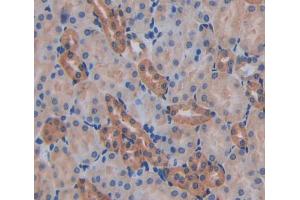 IHC-P analysis of kidney tissue, with DAB staining. (AFAP 抗体  (AA 352-572))