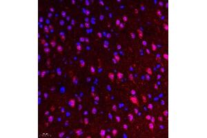 Immunofluorescence of paraffin embedded mouse brain using NSD3 (ABIN7076233) at dilution of 1:650 (400x lens) (WHSC1L1 抗体)