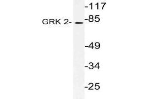 Western blot (WB) analysis of GRK 2 antibody in extracts from Jurkat cells. (GRK2 抗体)