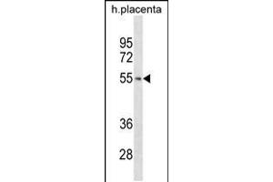 TARBP2 Antibody (N-term) ABIN2846967 western blot analysis in human placenta tissue lysates (35 μg/lane). (TARBP2 抗体  (N-Term))